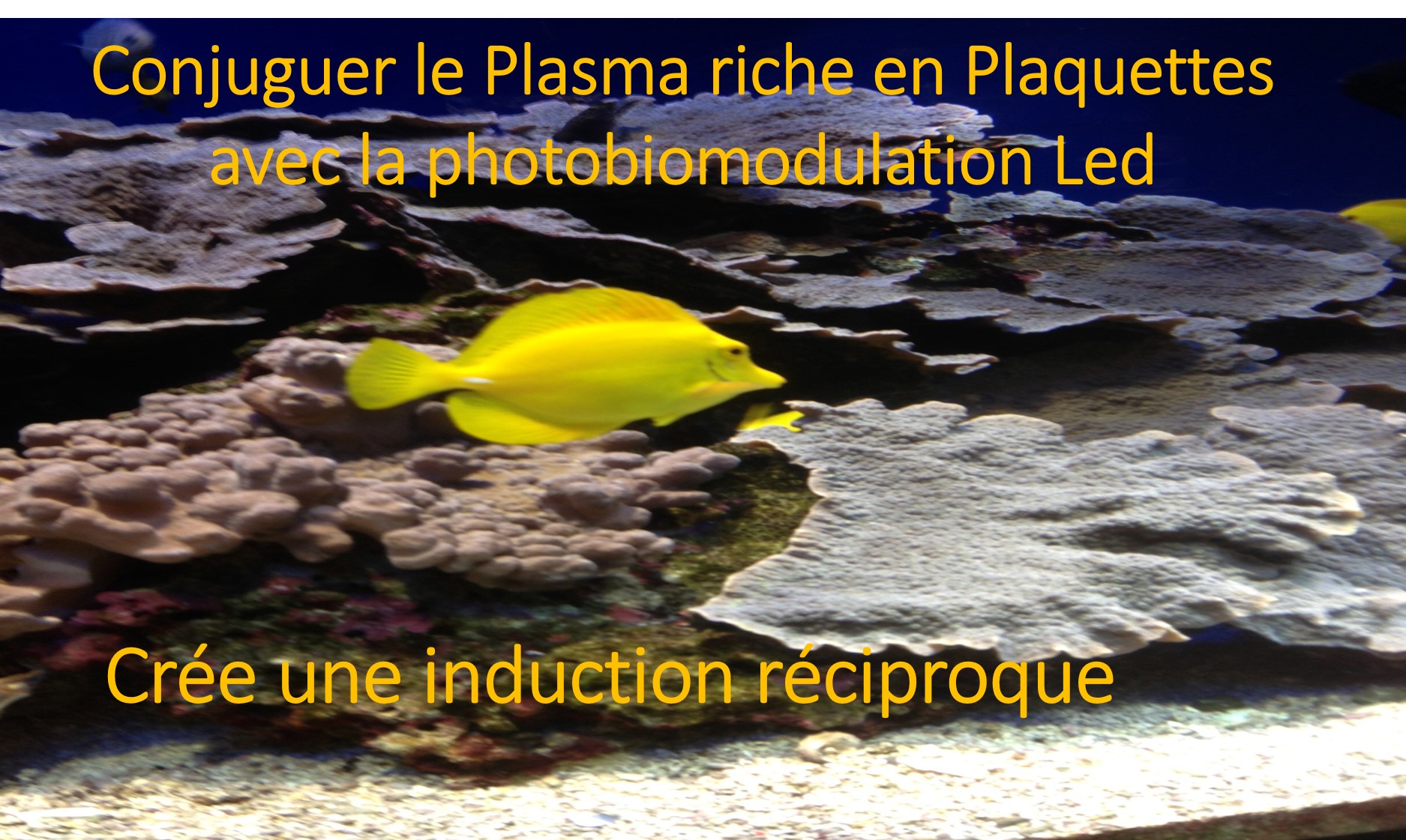 Conjuguer le Plasma riche en Plaquettes avec la photobiomodulation Led cree une induction reciproque  Dr Linda FOUQUE