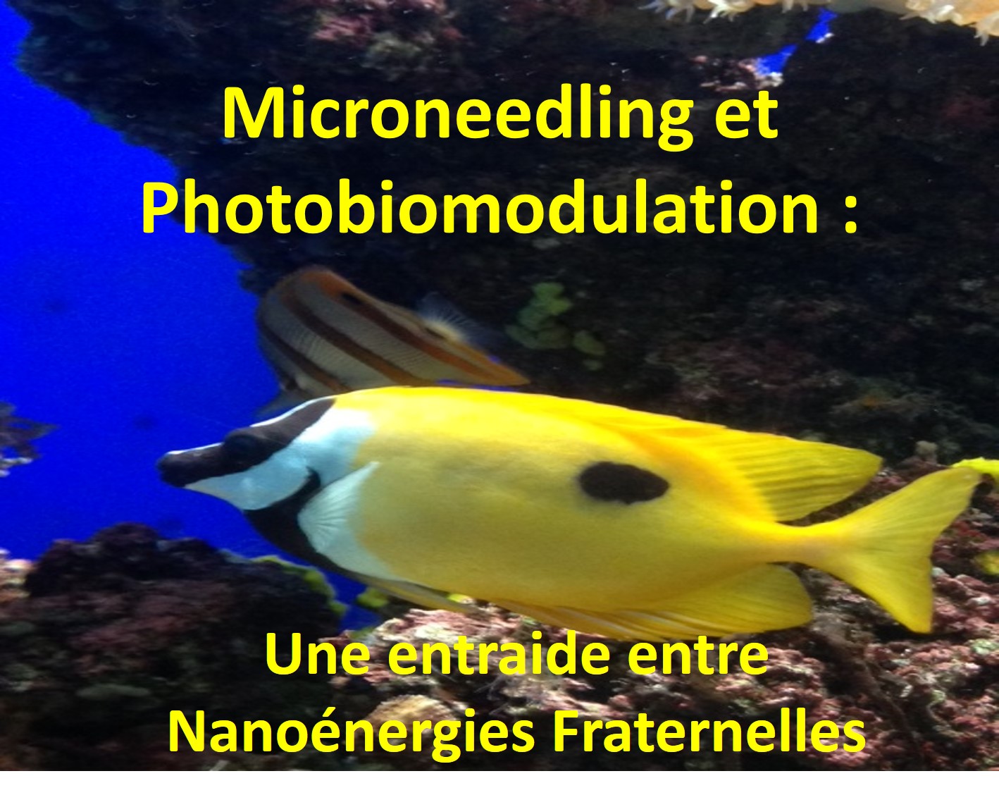 MICRONEEDLING et  PHOTOBIOMODULATION : Une ENTRAIDE  entre NANOENERGIES  FRATERNELLES - DR  G. CALDERHEAD