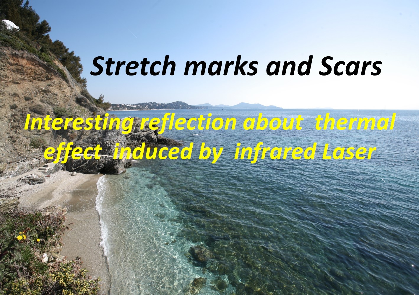 35th National Congress of Aesthetic Medicine and Dermatological Surgery Paris, September 12 & 13, 2014 - Stretch marks and Scars - Suzanne HAUSDORFER MD